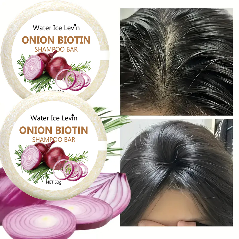 Onion & Biotin Shampoo Bar - 6 - Castor Oil Soap 리뷰 및 가격