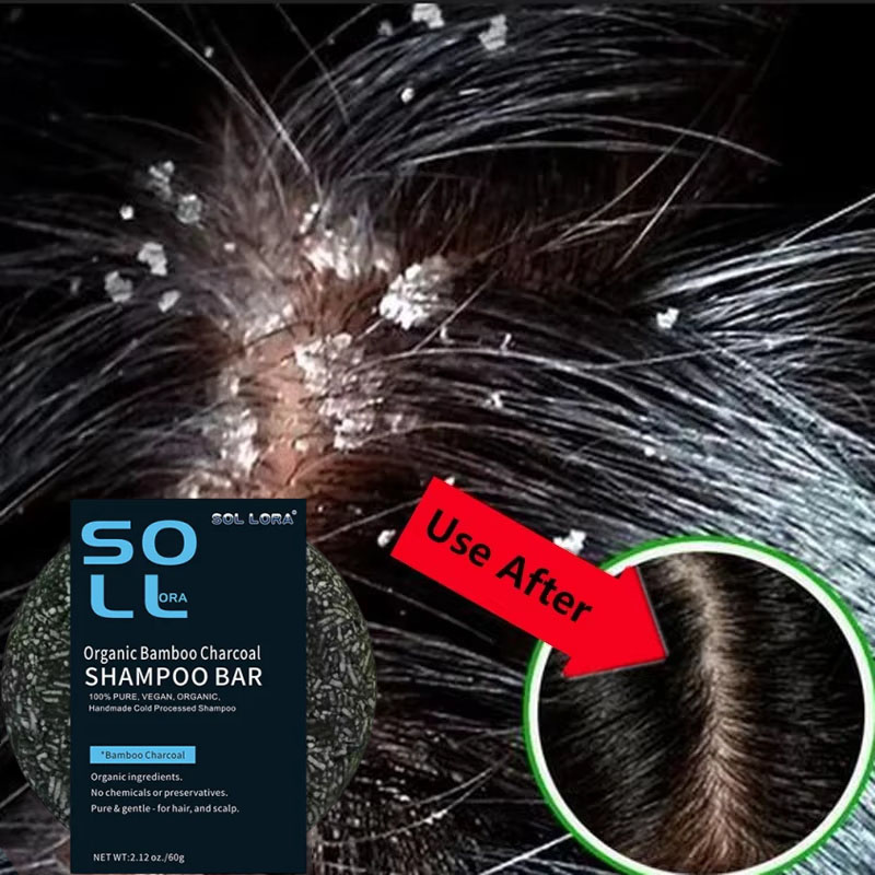 Fast Anti Dandruff Hair Treatm - Castor Oil Soap 리뷰 및 가격